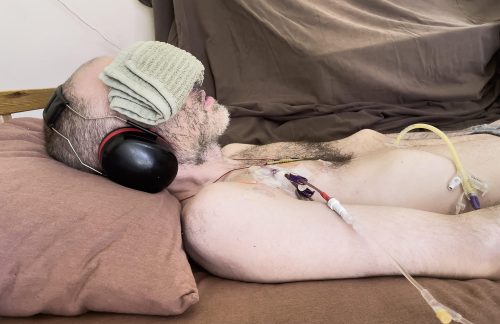 The image shows Whitney laying in a bed on a brown pillow with a towel over his eyes. On the right side of his chest, he has a medical tube attached.